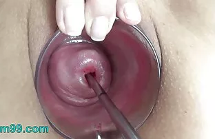 தீவிர கருப்பை வாய் கொண்ட ஒலியின் ஆழத்தில் கருப்பை