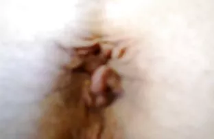 கேப்பிங்