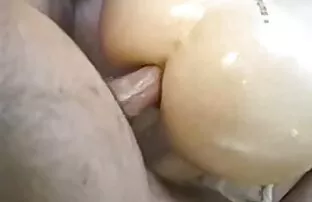 அனல் ஸ்கர்ட்