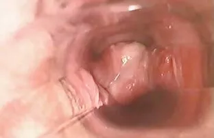புணர்ச்சியின் போது புண்டை உள்ளே l7