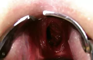 இரட்டை குத ஆய்வு தூரம்