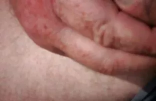 கடற்கரையில் ஃப்ளாஷ்
