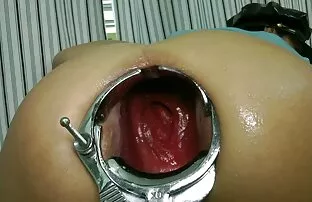 - முழங்கை ஆழமான ஃபிஸ்டிங் ப்ரோலாப்ஸ் ஸ்பெகுலம் எக்ஸ்ட்ரீம்